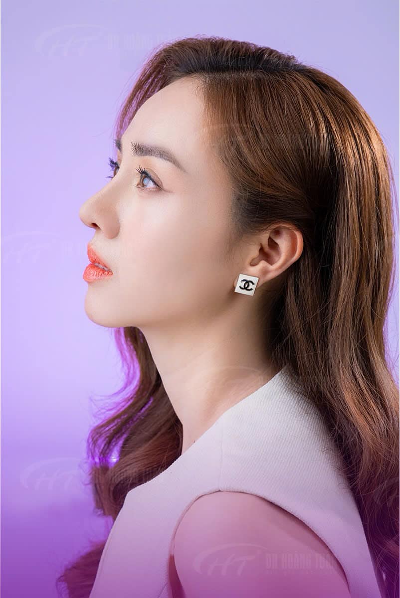 nâng mũi bao lâu thì đầu mũi hết to