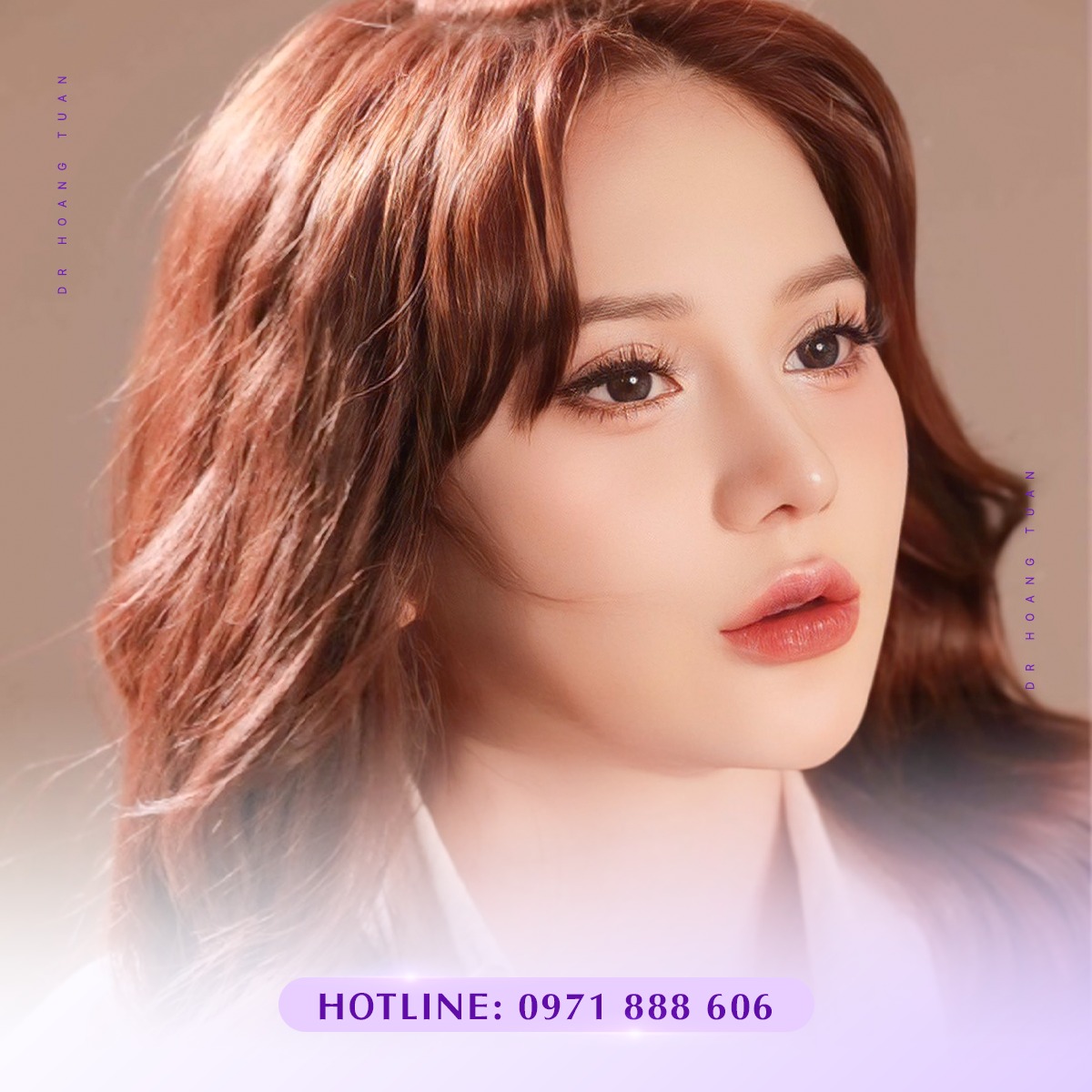 nâng mũi cấu trúc bao lâu thì gom lại