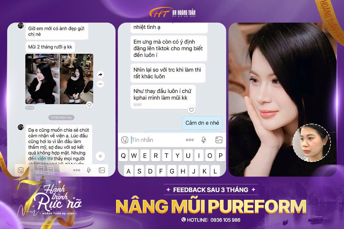 feedback n&acirc;ng mũi