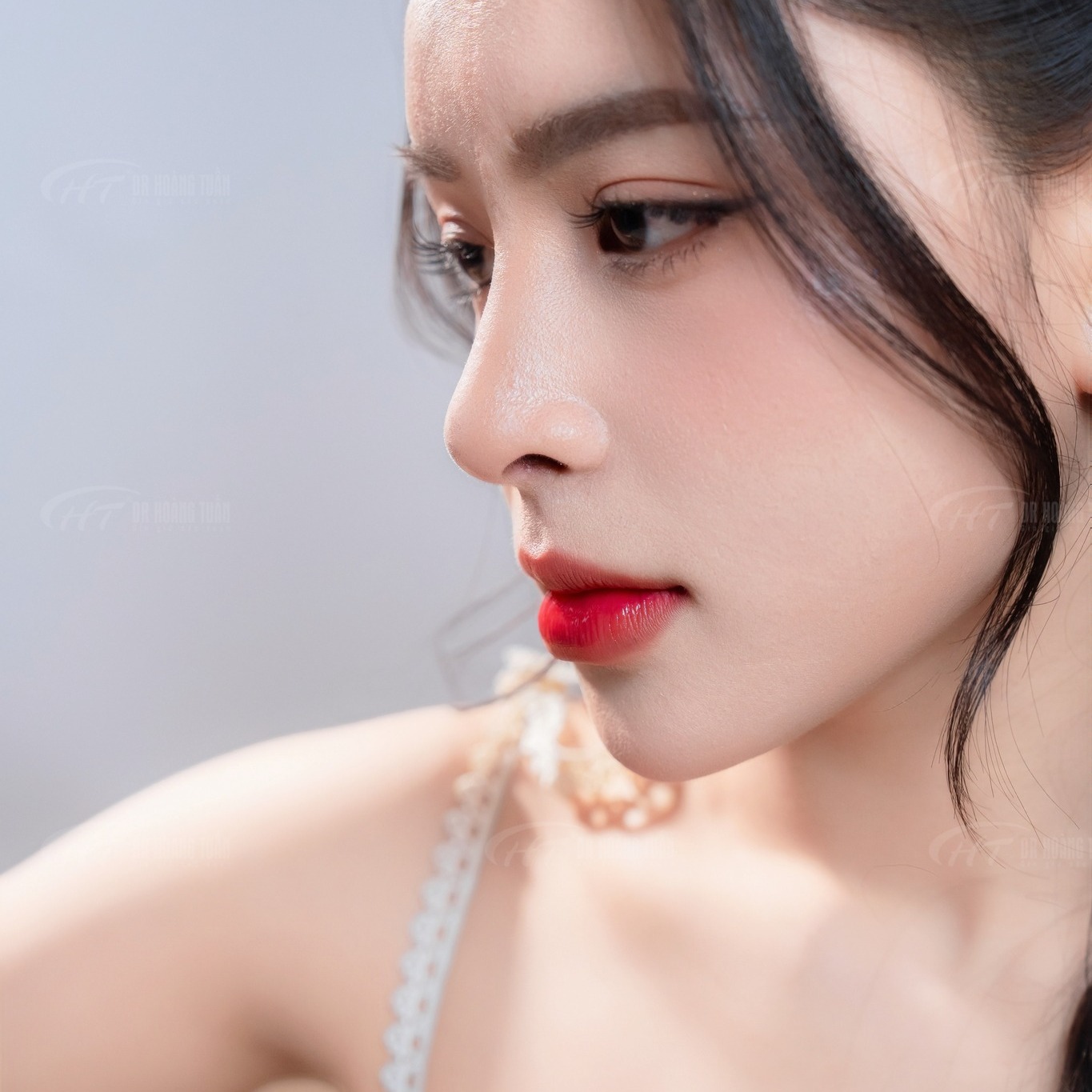 n&acirc;ng mũi S-line c&oacute; đẹp tự nhi&ecirc;n kh&ocirc;ng