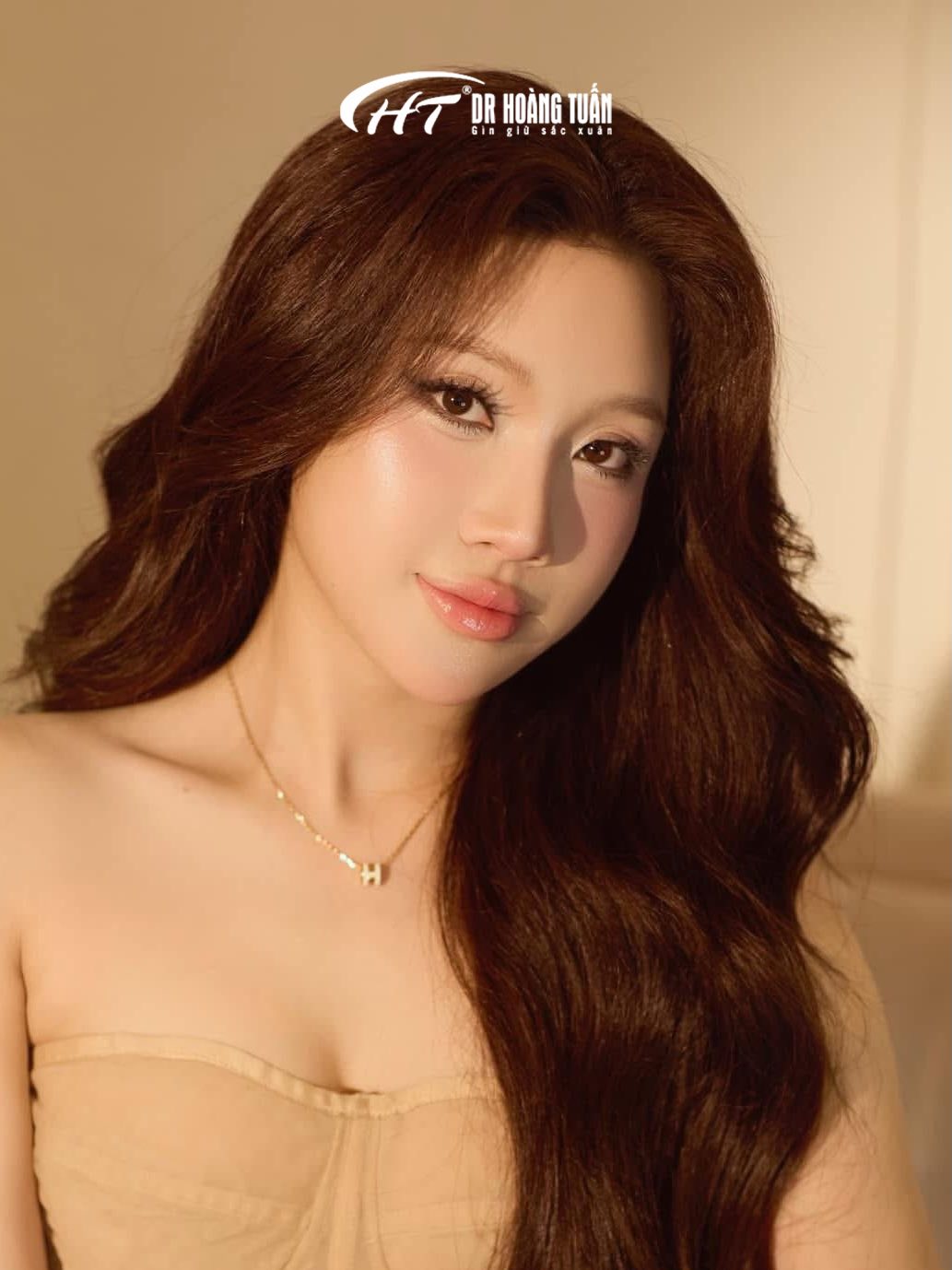 n&acirc;ng mũi S-line c&oacute; đẹp tự nhi&ecirc;n kh&ocirc;ng