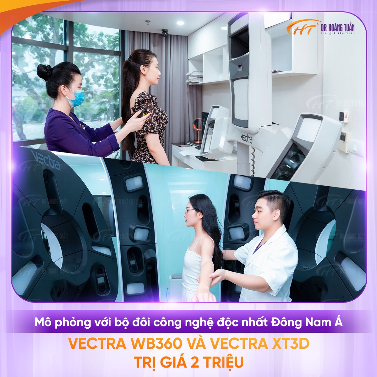 nâng mũi sụn sườn