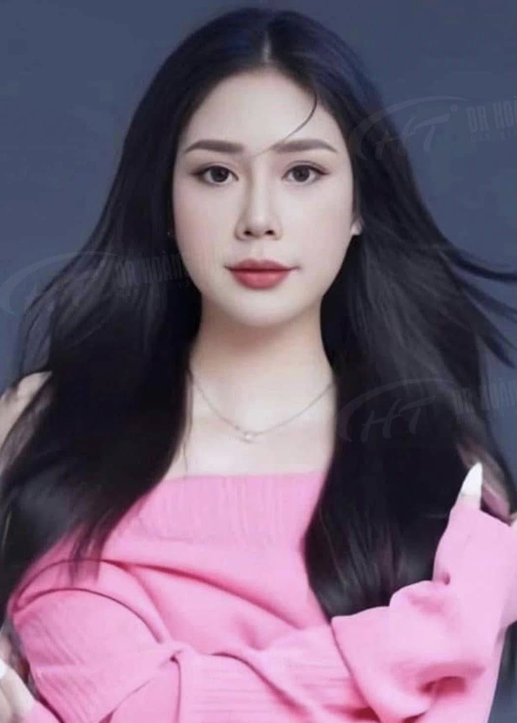 nâng mũi sụn tai