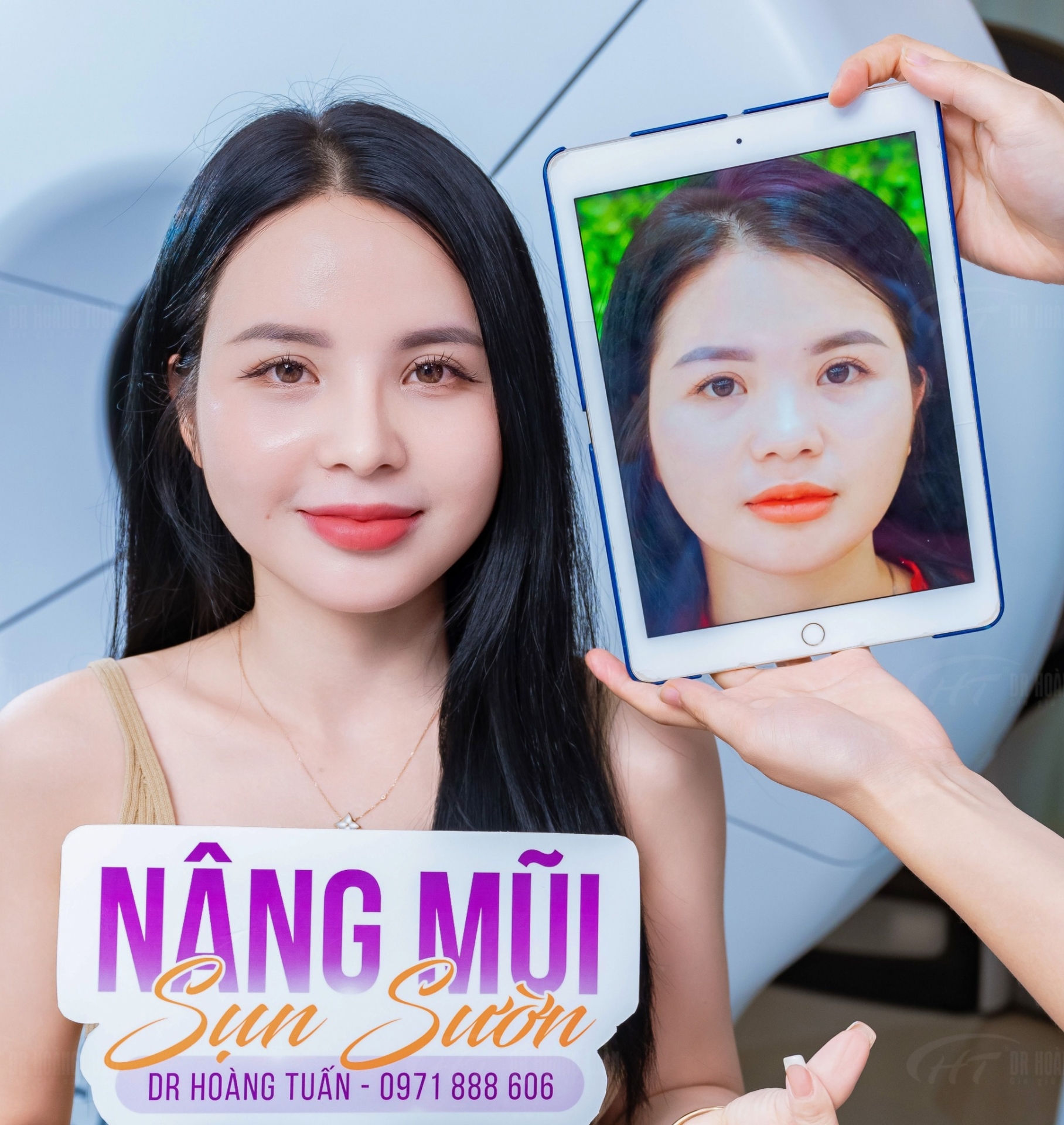 lưu &yacute; khi n&acirc;ng mũi