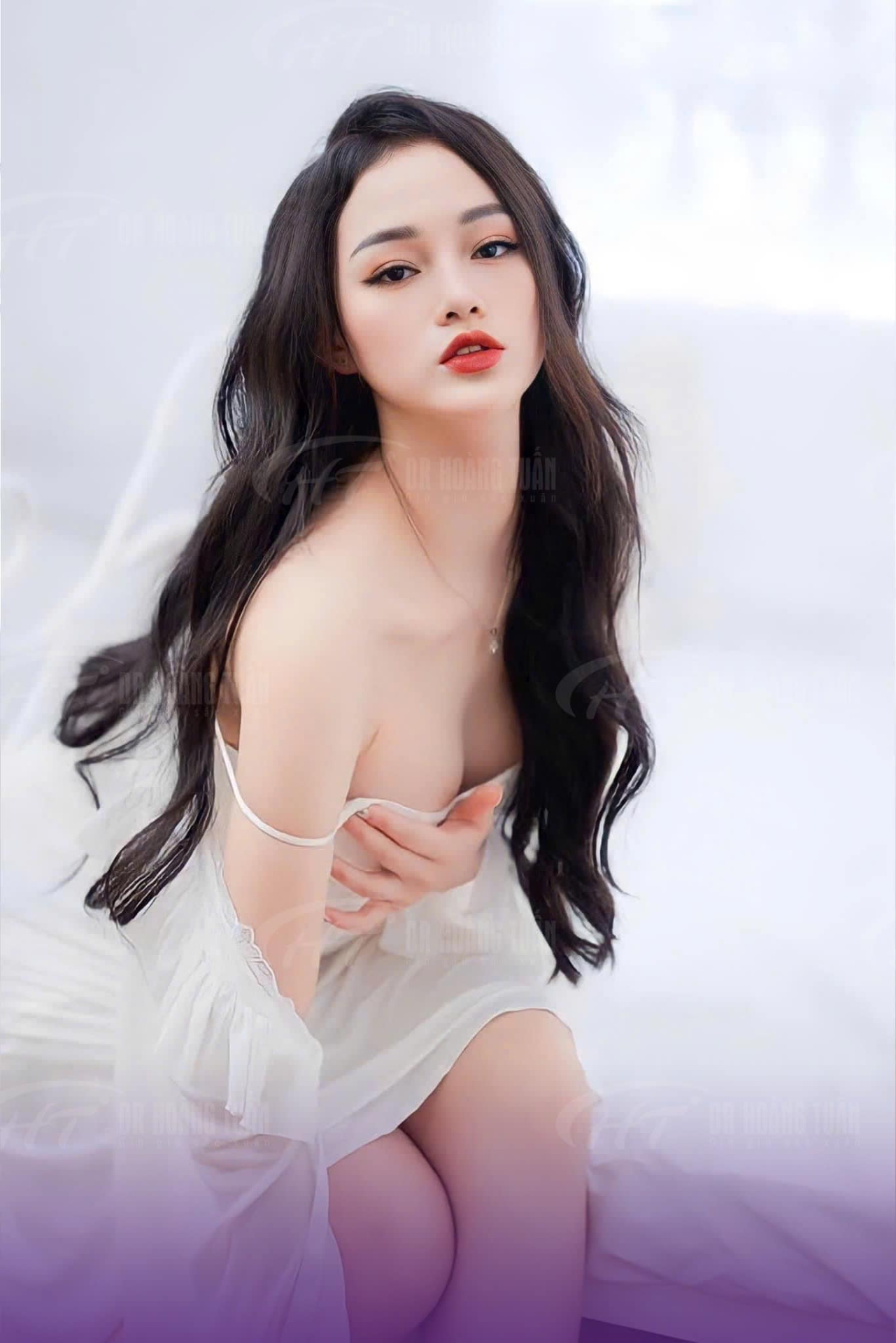 nâng ngực mấy ngày cắt chỉ
