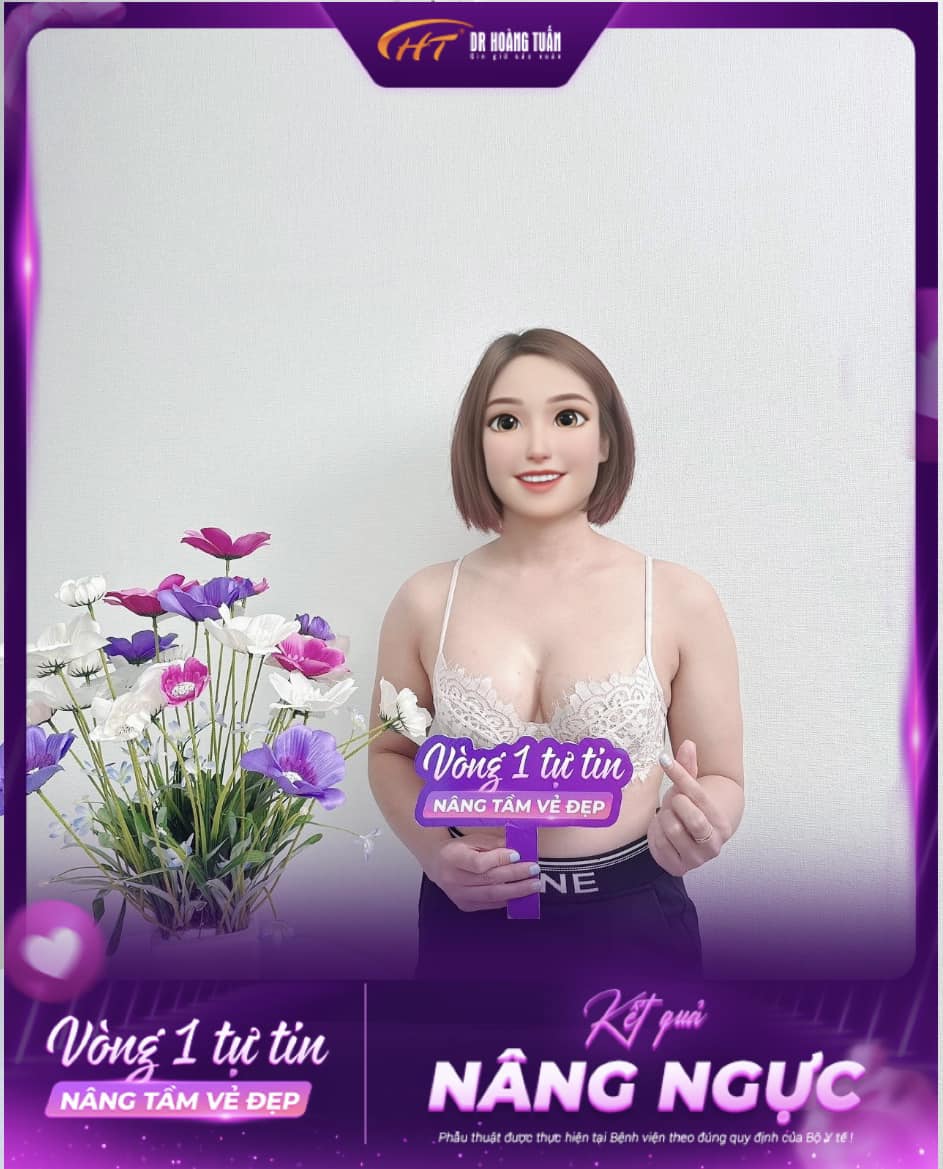 n&acirc;ng ngực c&oacute; t&aacute;c dụng phụ kh&ocirc;ng