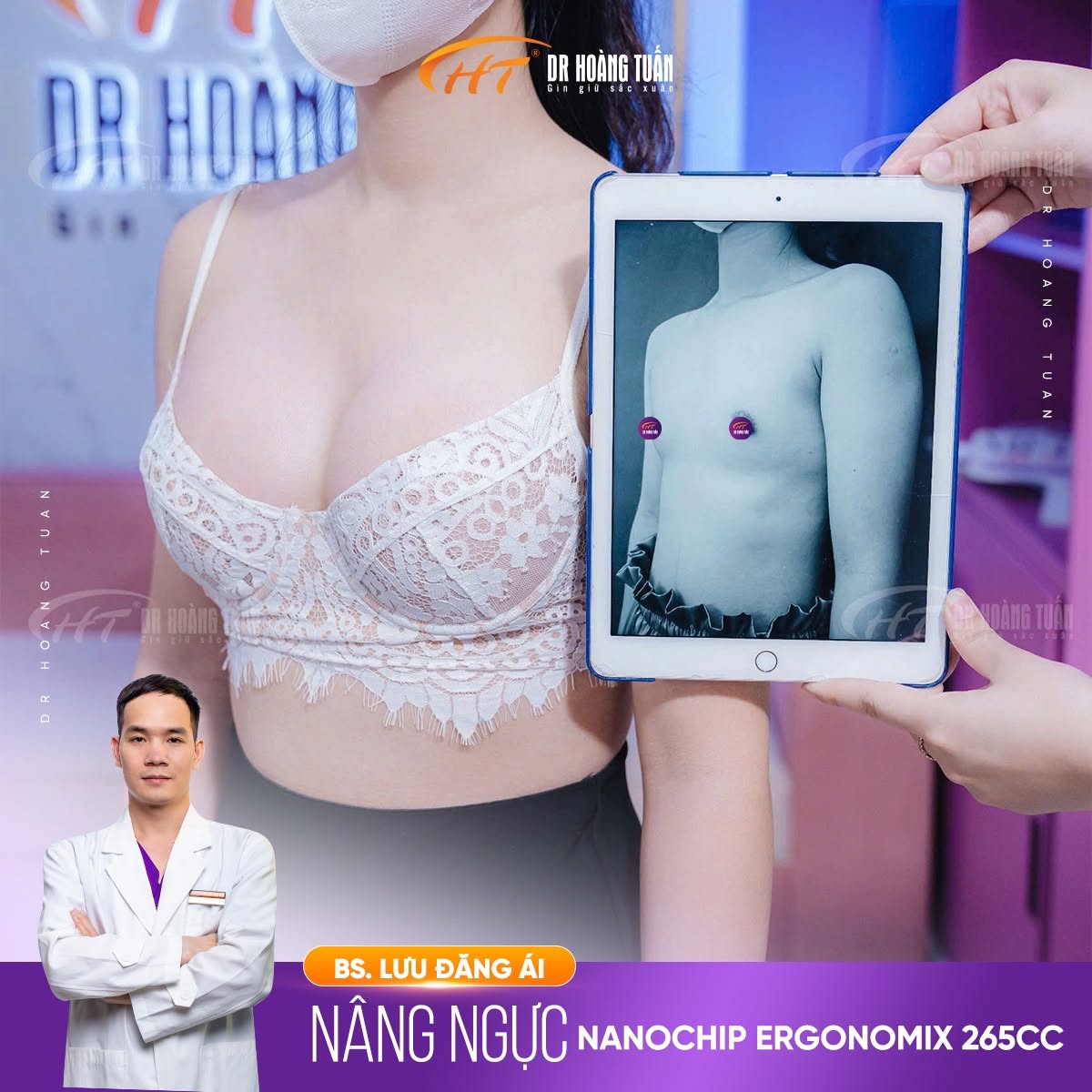 nâng ngực lép