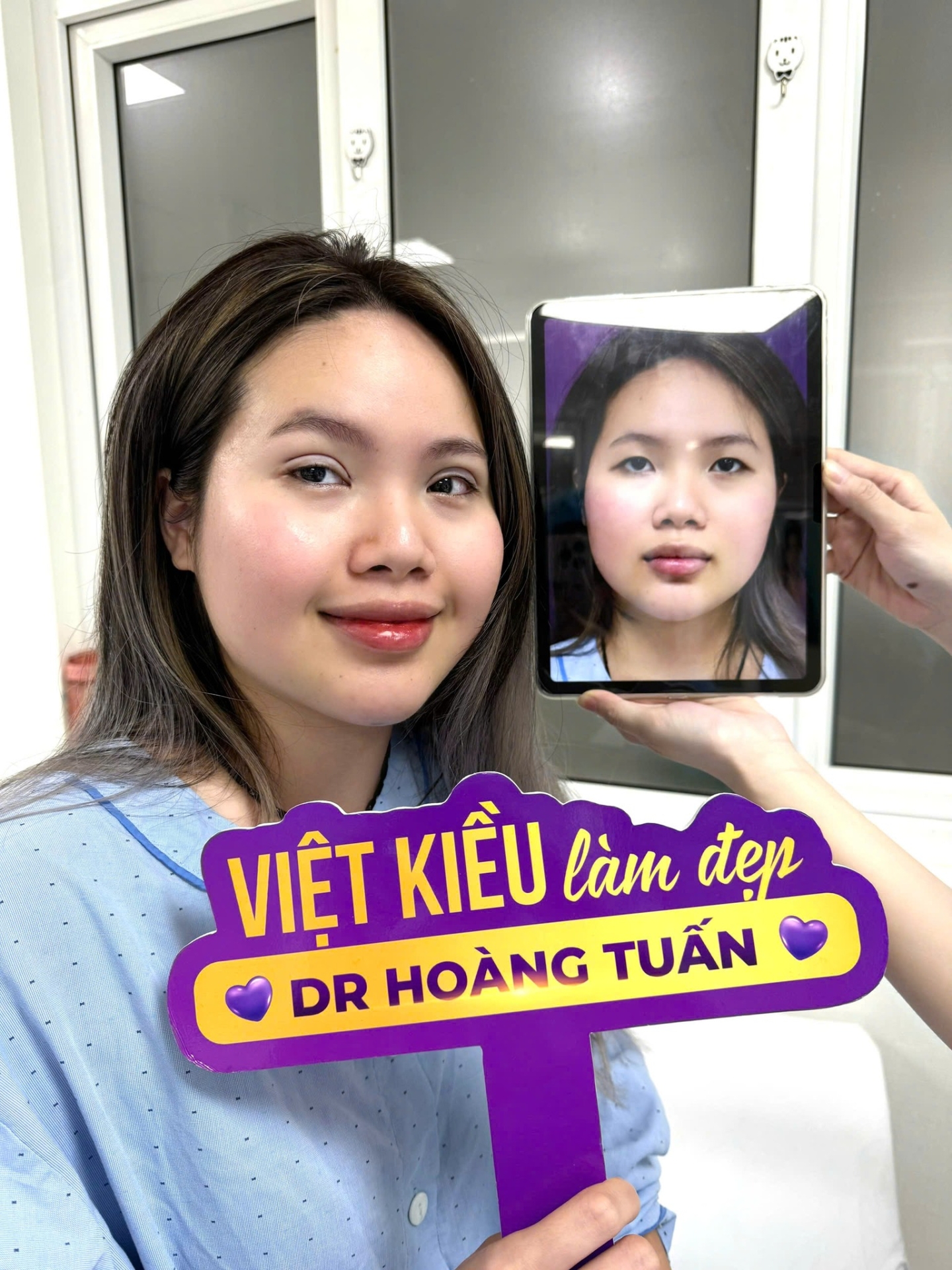 nhấn mí ở đâu đẹp hà nội