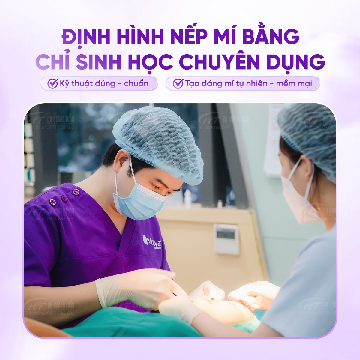 phẫu thuật thẩm mỹ mắt ở đâu tốt nhất