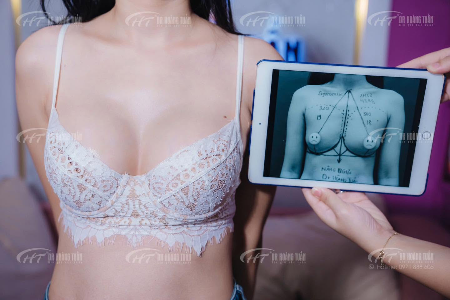treo sa trễ bao l&acirc;u th&igrave; l&agrave;nh