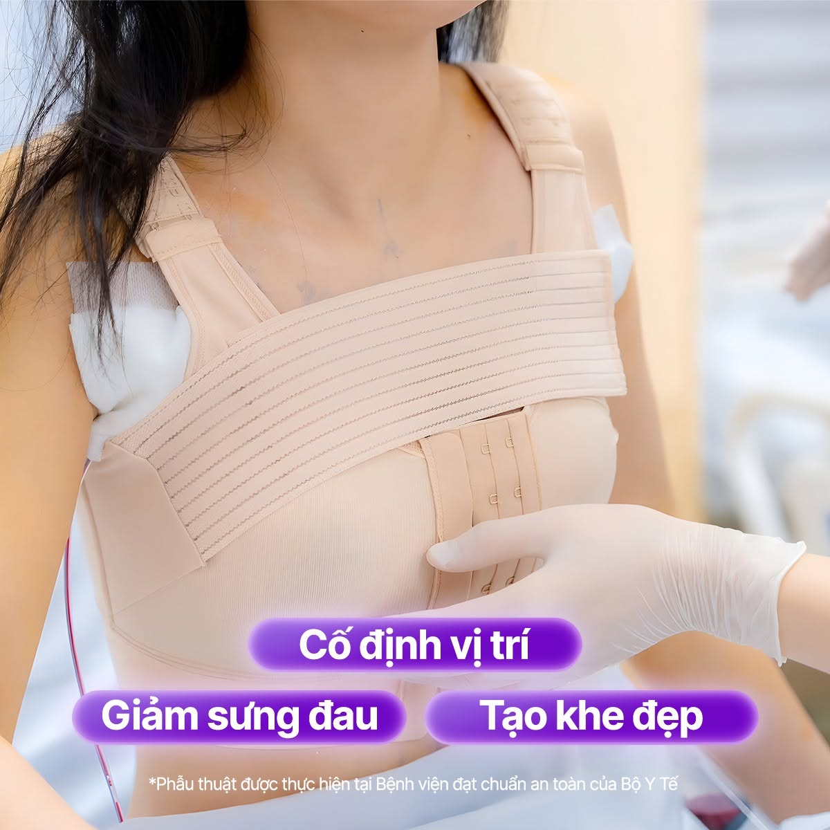 nâng ngực mặc áo định hình trong bao lâu