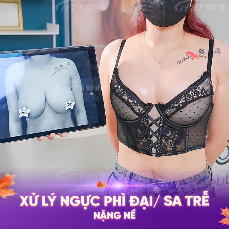 treo sa trễ bao l&acirc;u th&igrave; l&agrave;nh
