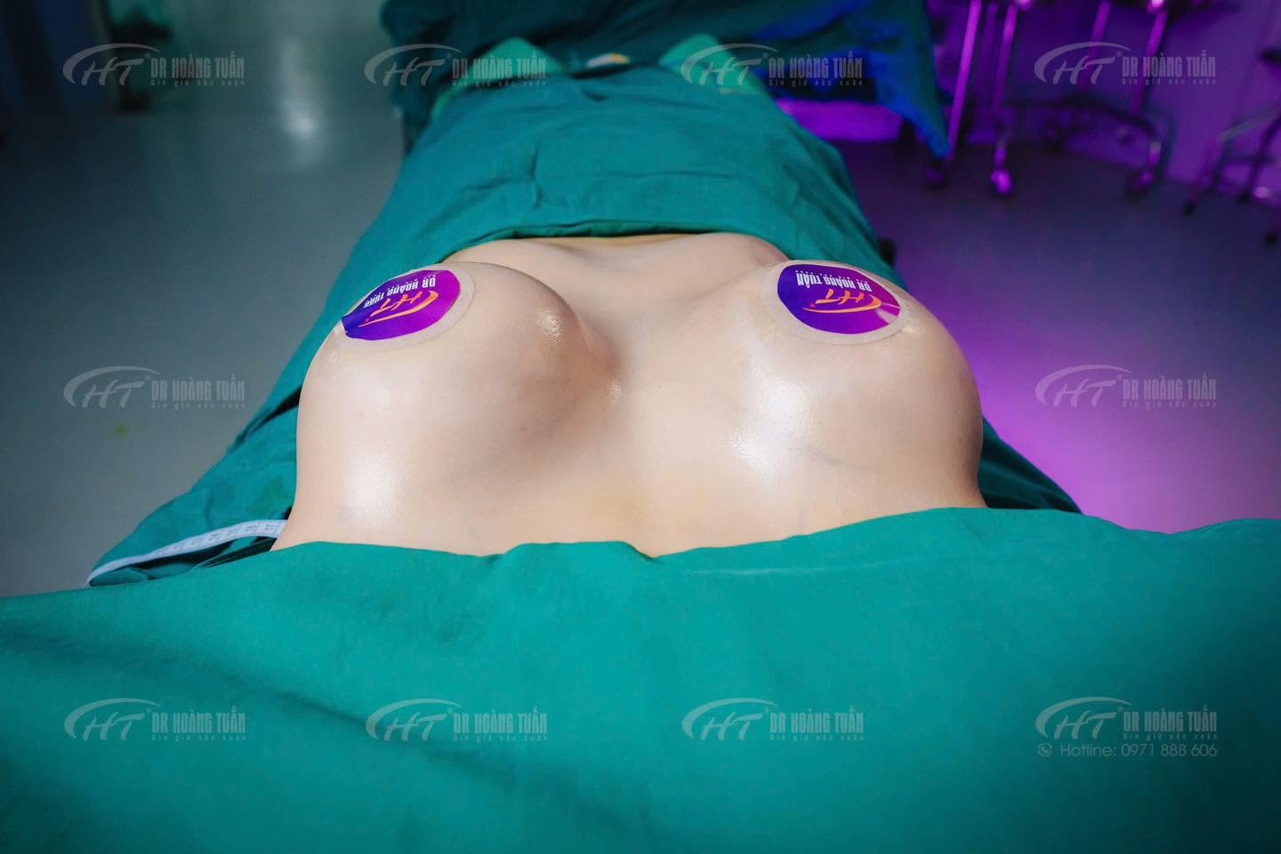 n&acirc;ng ngực t&uacute;i ergonomix