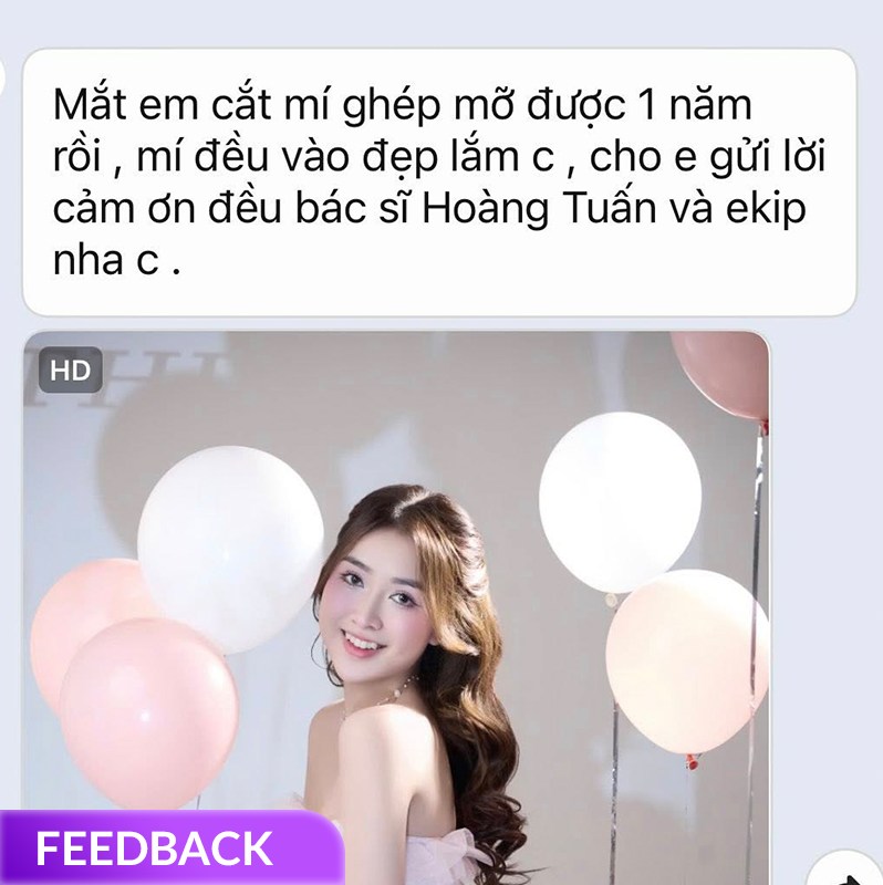 phẫu thuật thẩm mỹ mắt to có an toàn không