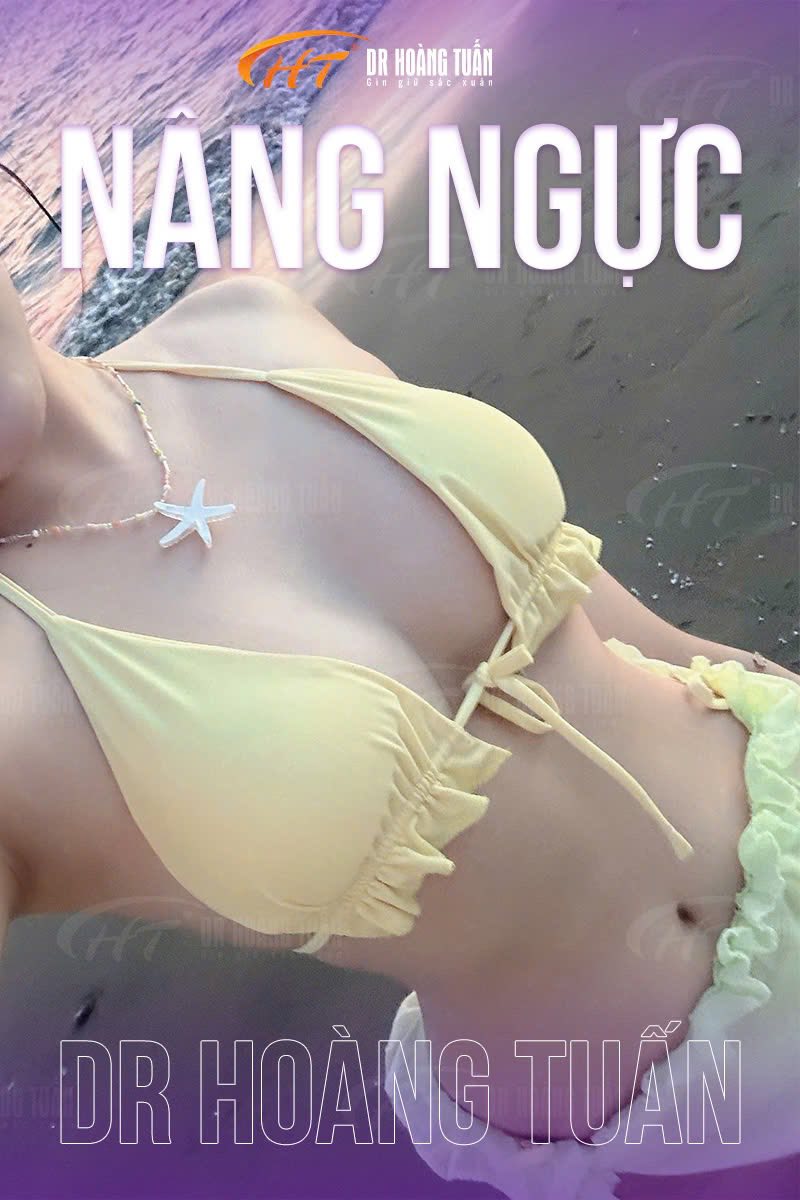 tìm hiểu về nâng ngực bằng mỡ tự thân