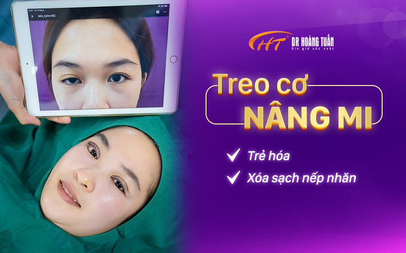 các phương pháp phẫu thuật thẩm mỹ mắt