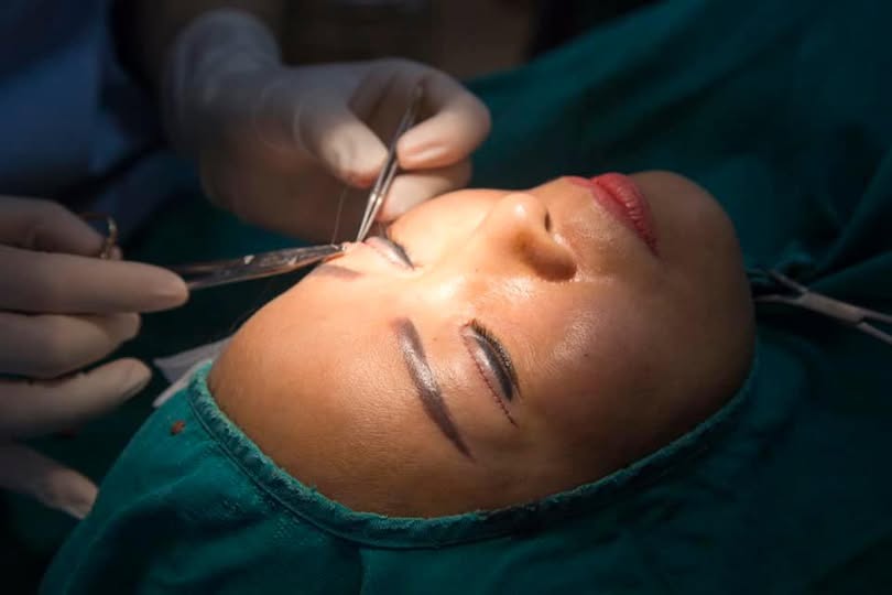 n&acirc;ng cung m&agrave;y bao l&acirc;u th&igrave; hết sẹo
