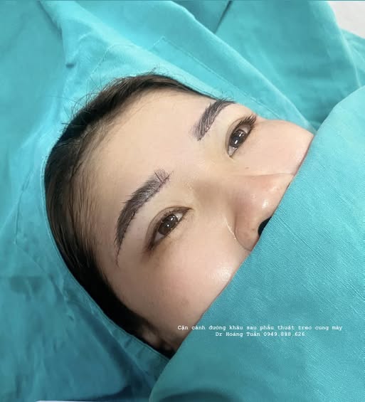 treo cung m&agrave;y ki&ecirc;ng ăn g&igrave;