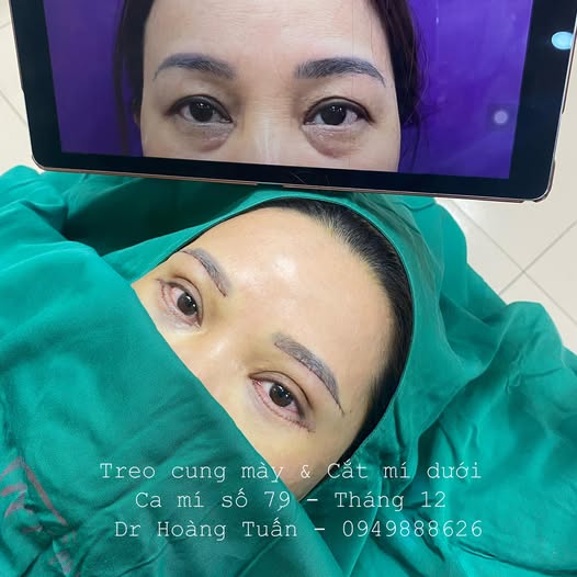 nâng cung mày ở đâu đẹp hà nội
