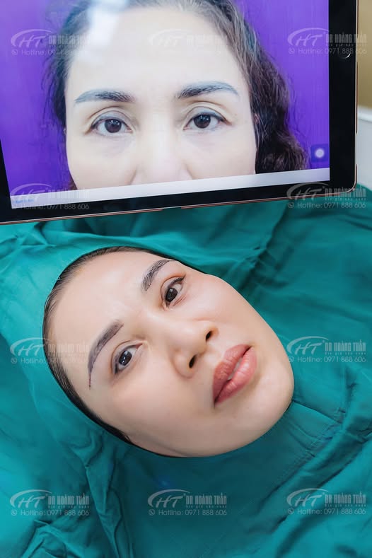 nâng cung mày ở đâu đẹp hà nội