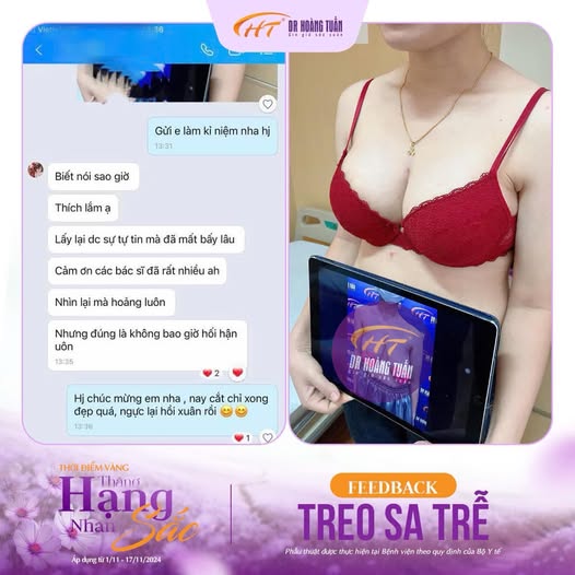 treo sa trễ không đặt túi có đẹp không