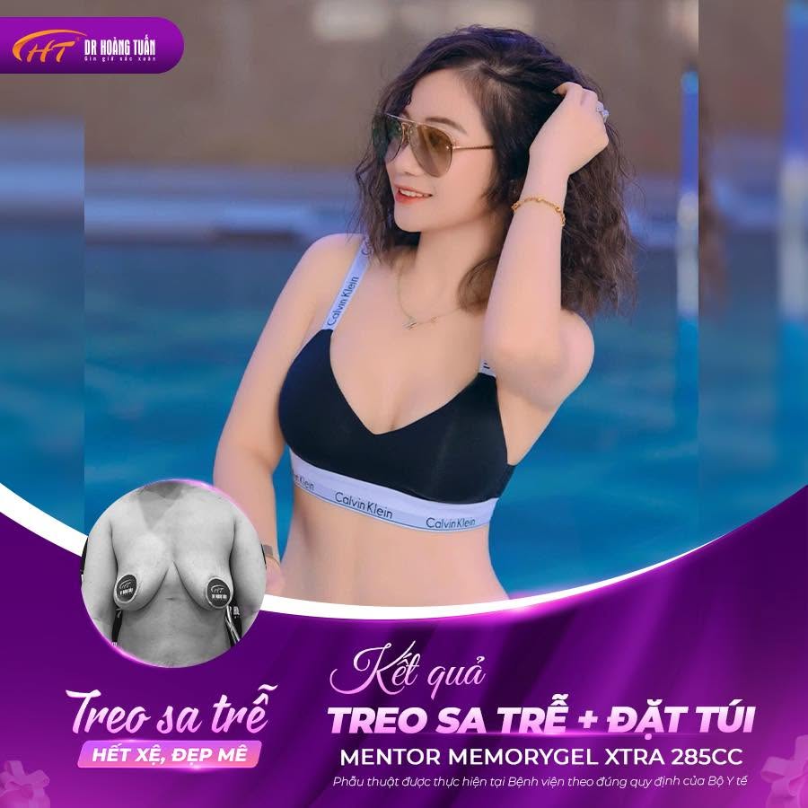 treo sa trễ đặt t&uacute;i