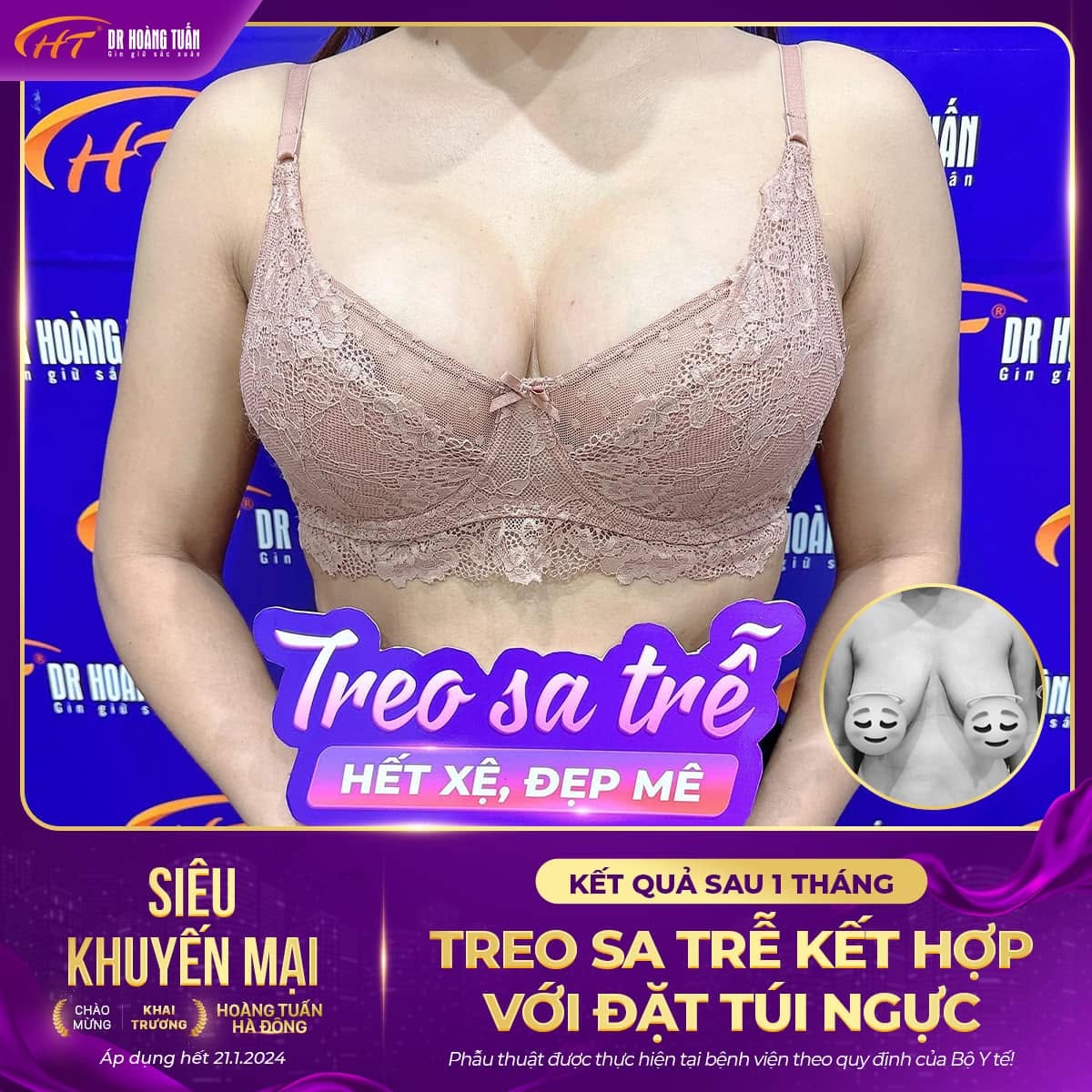 treo sa trễ đặt t&uacute;i