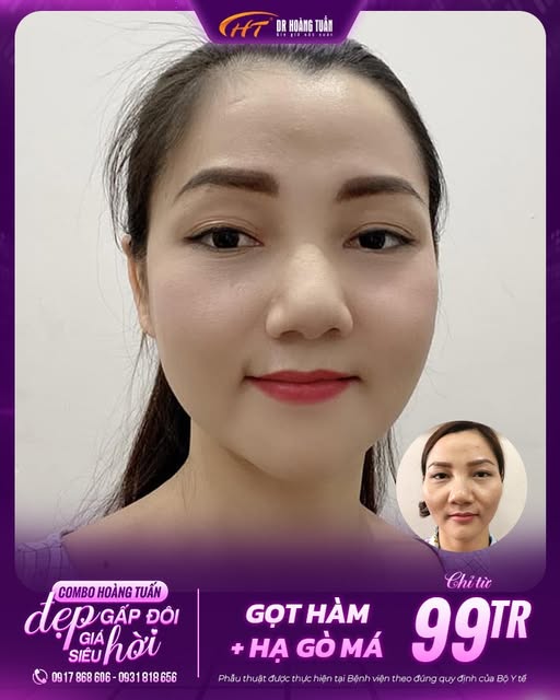 hạ g&ograve; m&aacute; c&oacute; an to&agrave;n kh&ocirc;ng