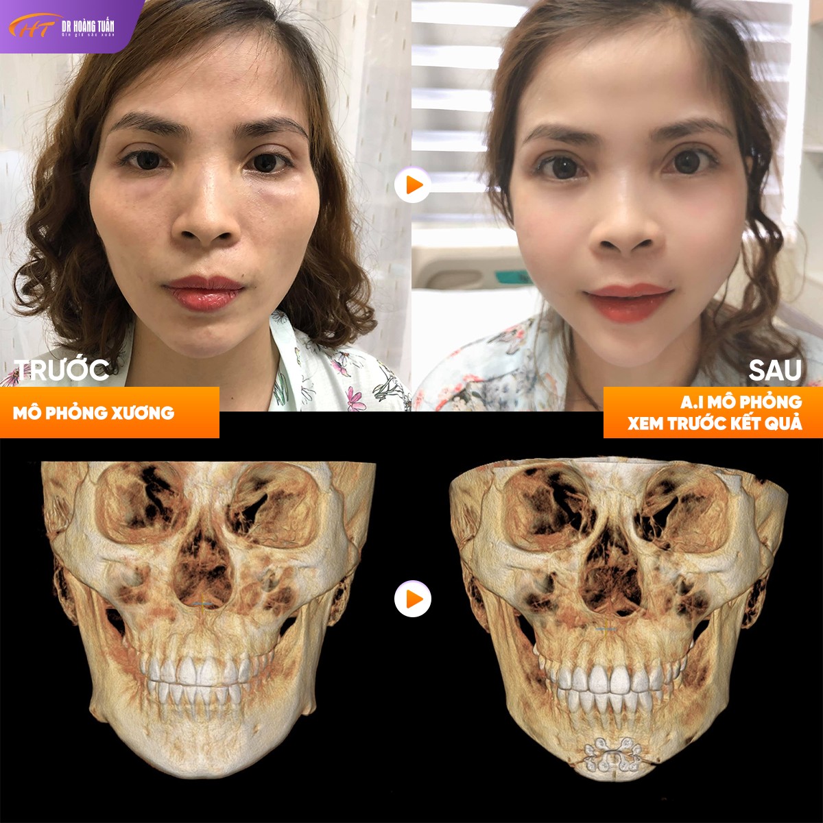 HT 3D Smart Cut