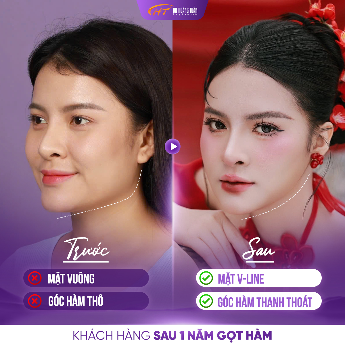HT 3D Smart Cut
