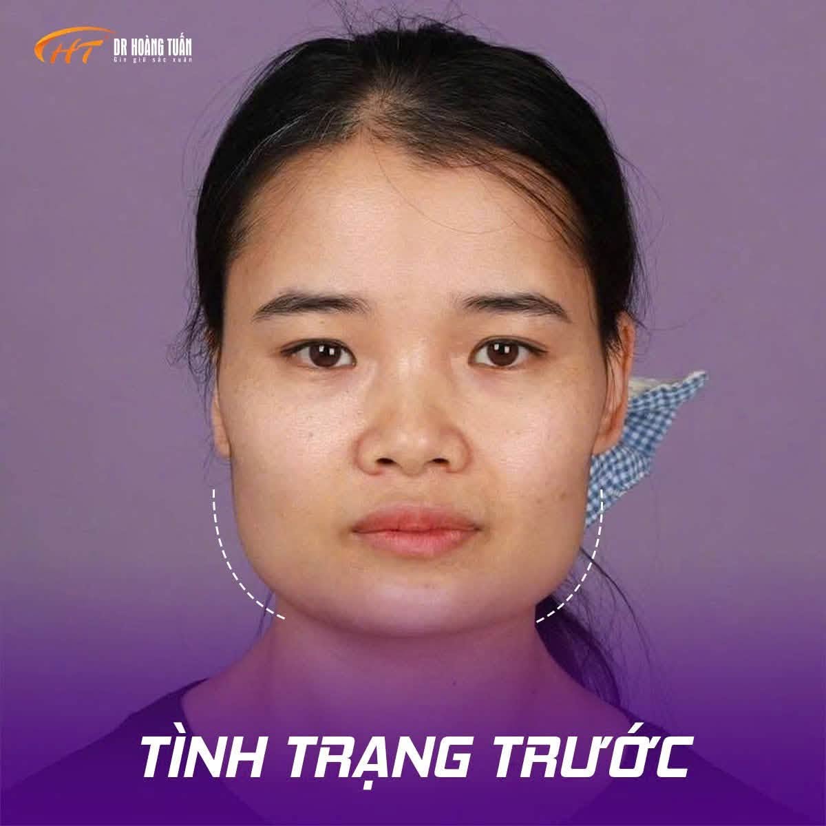 gọt h&agrave;m vu&ocirc;ng