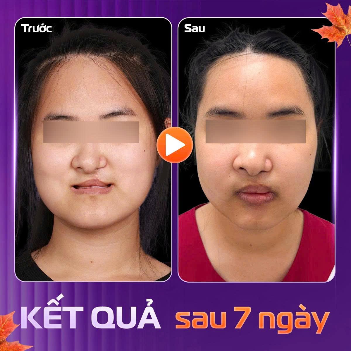 gọt h&agrave;m vu&ocirc;ng