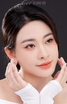 Nhấn mí bao lâu thì hồi phục? Cách chăm sóc sau nhấn mí