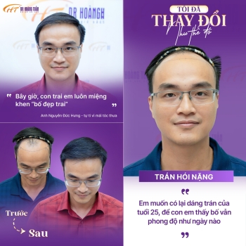 Tôi đã thay đổi như thế đó - Khi người đàn ông “thắng đời” bằng mái tóc mới