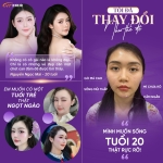 Ngọc Mai hoá visual hotgirl tại Thẩm mỹ Hoàng Tuấn