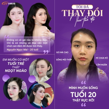 Ngọc Mai hoá visual hotgirl tại Thẩm mỹ Hoàng Tuấn