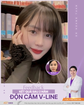 ĐỘN CẰM