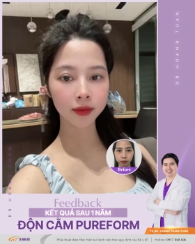 ĐỘN CẰM