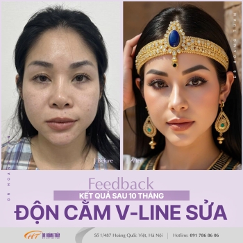 ĐỘN CẰM