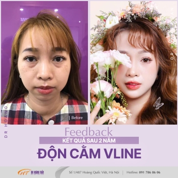 ĐỘN CẰM