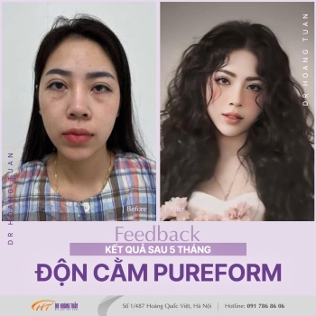ĐỘN CẰM