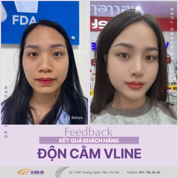 ĐỘN CẰM