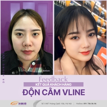ĐỘN CẰM
