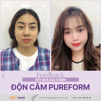 ĐỘN CẰM