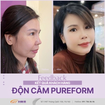 ĐỘN CẰM