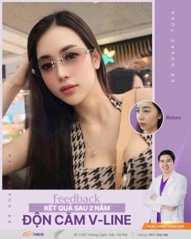ĐỘN CẰM