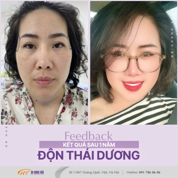 ĐỘN THÁI DƯƠNG