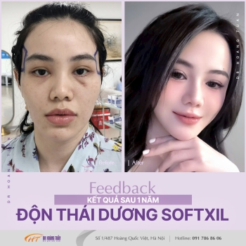 ĐỘN THÁI DƯƠNG