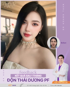 ĐỘN THÁI DƯƠNG
