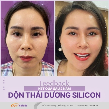ĐỘN THÁI DƯƠNG